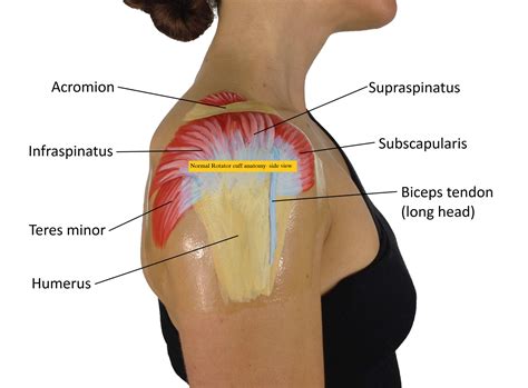 Rotator Cuff Syndrome Physiocure