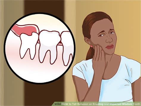 How To Tell Between An Erupting And Impacted Wisdom Tooth 9 Steps