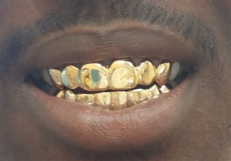 Custom gold grillz offers high quality grillz and gold slugs at a fraction of the current market price! Gold Grillz Miami