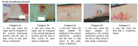 Figure 1 From Star A Consensus For Skin Tear Classification