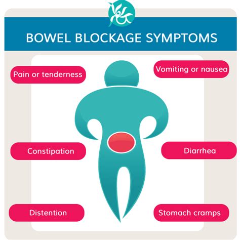 Symptoms Of Blocked Bowel