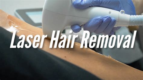Laser Hair Removal Youtube