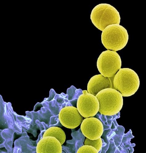 Staphylococcus Aureus Bacteria Image Eurekalert Science News Releases