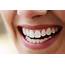 11 Ways To Naturally Whiten The Teeth