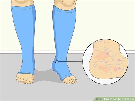 7 Simple And Effective Ways To Soothe Itchy Legs