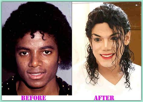 Look At Michael Jackson Plastic Surgery Michael Jackson Plastic Surgery Before After Plastic