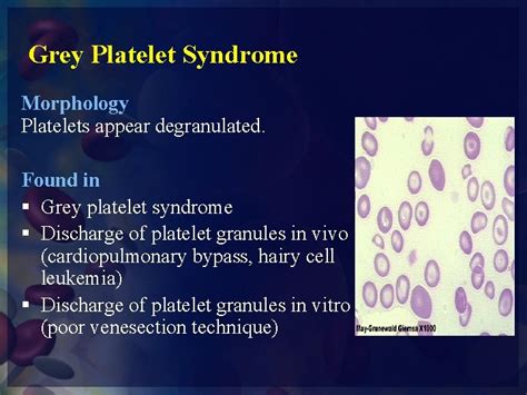Practical Hematology Lab Wbcs Plt Abnormal Morphology Platelet
