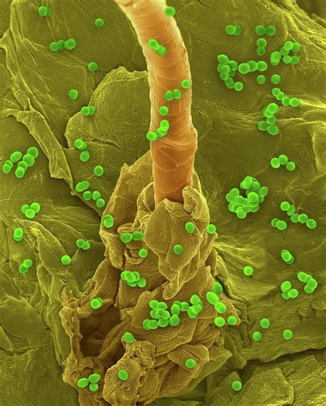 Enterococcus Faecium On Human Skin Photograph By Dennis Kunkel
