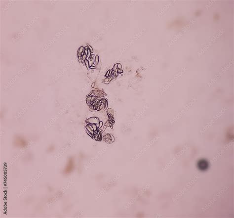 Giardia Lamblia Cysts And Trophozoite Form Muscle Fiber In Stool