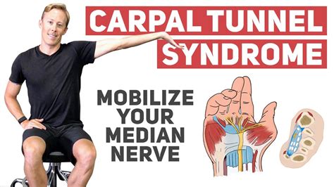 Nerve Mobilization For Carpal Tunnel Syndrome Youtube