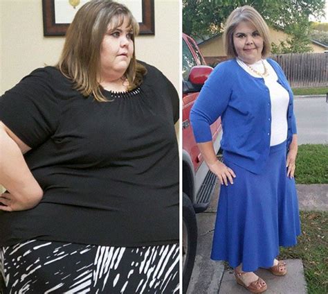 Unbelievable Before And After Transformation Photos Others