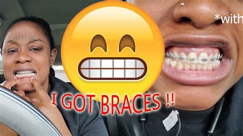 I Got Braces 😁 Adult Braces Journey Vlog 1 Officialkfreshh Youtube