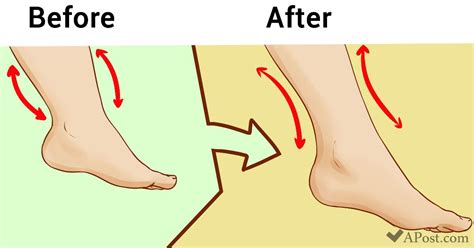 What Are Cankles And How You Can Get Rid Of Them With These 7 Tips