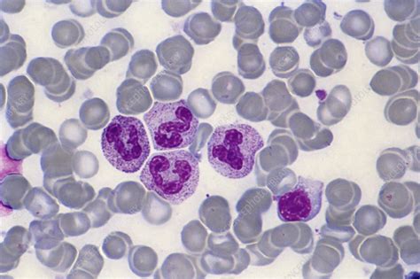 Bone Marrow Blood Cells Light Micrograph Stock Image C0151790