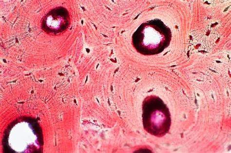 Having been constructed in the 16th century, microscopes have revolutionalized science with their ability to magnify small objects such as microbial cells, producing images with definitive structures that are. Histology Of Human Compact Bone Tissue Under Microscope ...