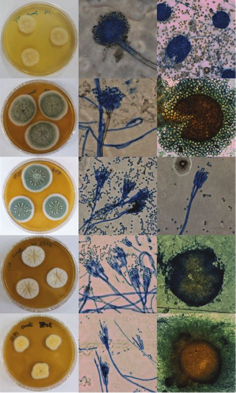 Varias Especies De Penicillium Aspergillus Y Otros Hongos Creciendo En