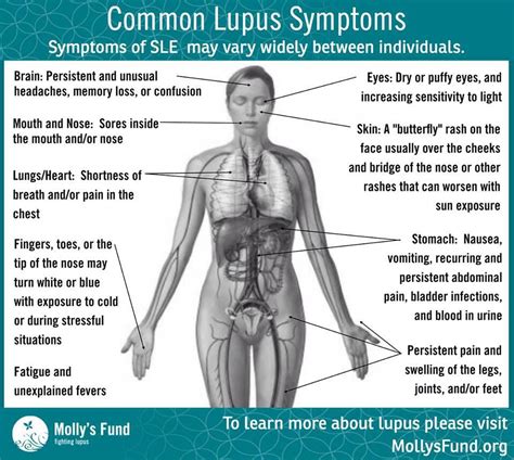 Common Lupus Symptoms Musely
