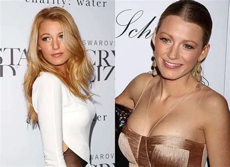 Blake Lively Breast Implants Nose Job Plastic Surgery Before And After Celebie