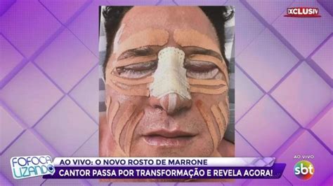 VÍDEO Após mudar de rosto com cirurgias Marrone mostra o resultado