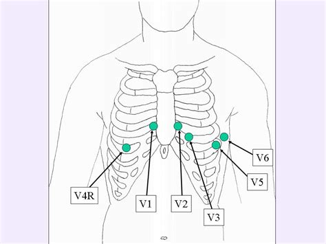 Photo 5 72 960×720 Pixels Ekg Interpretation Cheat Sheets Ekg