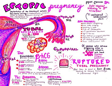 The Em Educator Series Ectopic Pregnancy Laptrinhx News