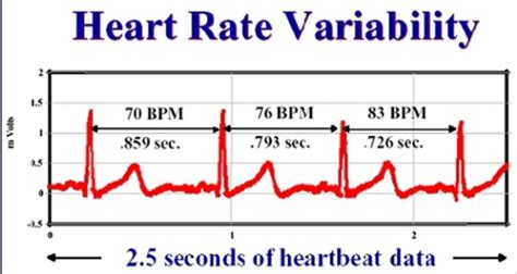 Hrv Heart Rate Variability Positively Whole Health