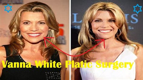Vanna White Plastic Surgery Before And After Youtube