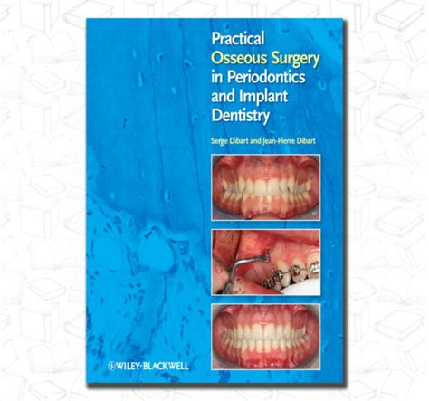 Practical Osseous Surgery In Periodontics And Implant Dentistry Dent13
