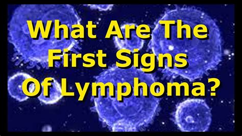 What Are The First Signs Of Lymphoma Youtube