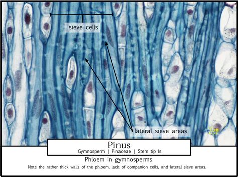 Lab 4 3b) Sieve cells in Pinus stem tip ls | Plant Anatomy L… | Jen