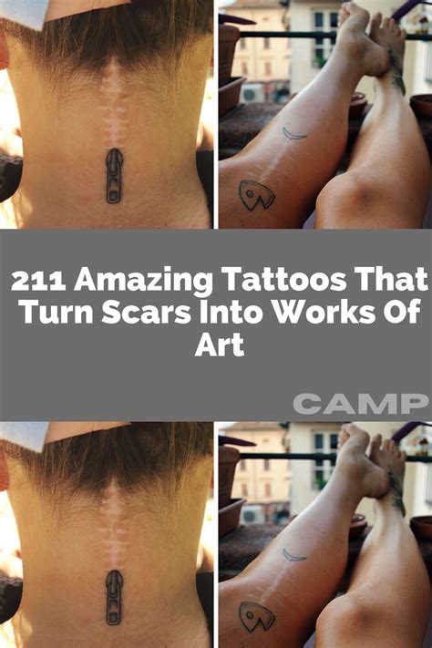 211 Amazing Tattoos That Turn Scars Into Works Of Art Artofit