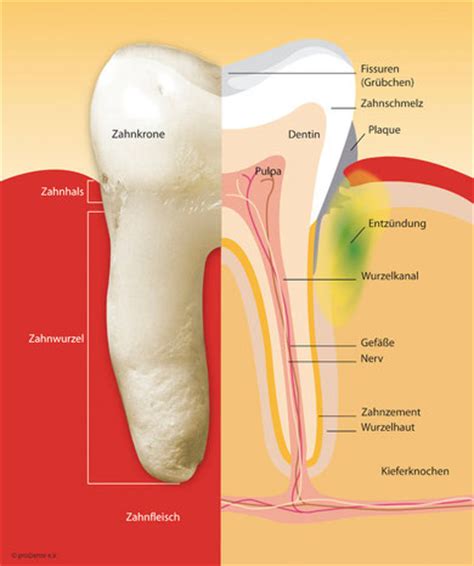 Parodontitis Behandlung Zahnarztpraxis Rupprecht