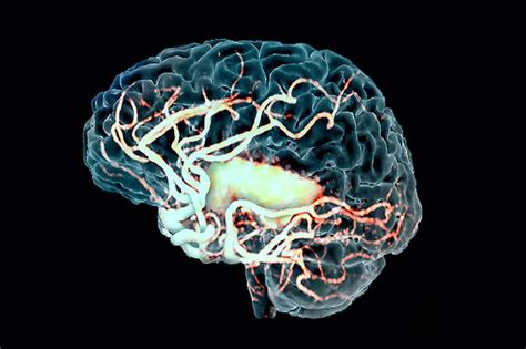 See Through Brains Reveal How Stroke Damages Vital Blood Vessels New