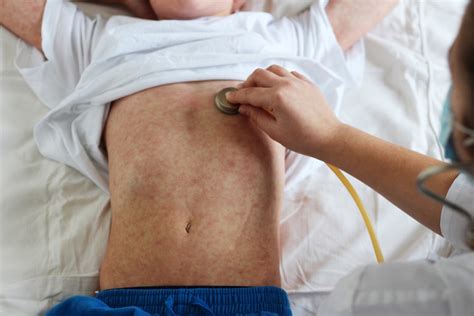 7 Coronavirus Symptoms In Kids You Need To Know Best Lifebest Life