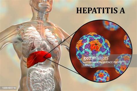 Hepatite A Photos Et Images De Collection Getty Images