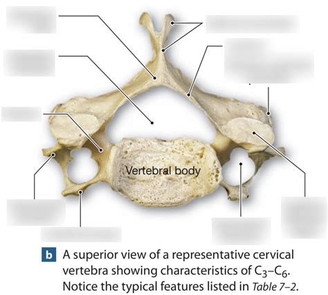 Cervical Vertebrae Superior View Diagram Quizlet