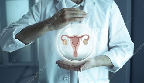 Reproductive System Infertility Treatment Stock Image F036 5908 Science Photo Library