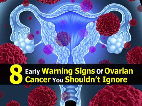 Early stage ovarian cancer does not present distinct symptoms, which is why it can grow unnoticed in the abdominal cavity area, without causing pain. Early Warning Signs That Ovarian Cancer Is Growing in Your ...
