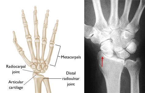 Wrist Joint Anatomy