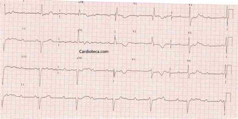 Simple Science: How to Make a Volcano with Kids