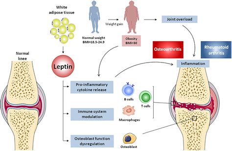 Frontiers Obesity Fat Mass And Immune System Role For Leptin