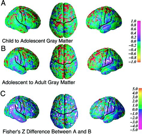 Fig 1 Mapping Continued Brain Growth And Gray Matter Density