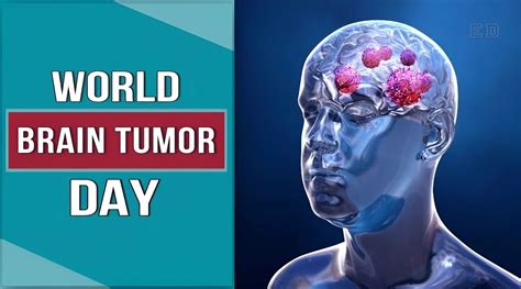 World Brain Tumor Day 2023 History Significance And Wishes