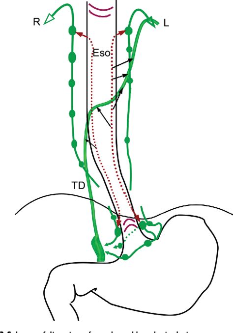 Figure 3 From Anatomy Of Lymphatic Drainage Of The Esophagus And Lymph