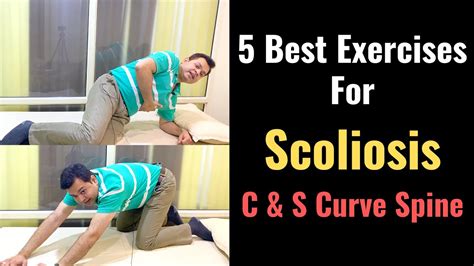Best Exercises For Scoliosis How To Correct Scoliosis Stretches For