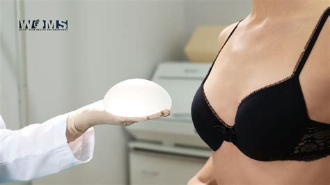 how long does breast augmentation last when should they be replaced woms