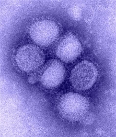 Fileh1n1 Influenza Virus Wikipedia The Free Encyclopedia