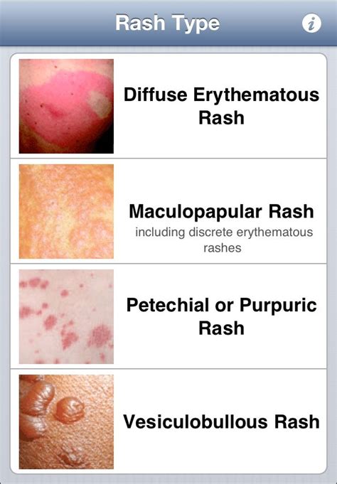 Pin By Gm Lailie On Medical Notes Skin Rash Rashes Infection Prevention