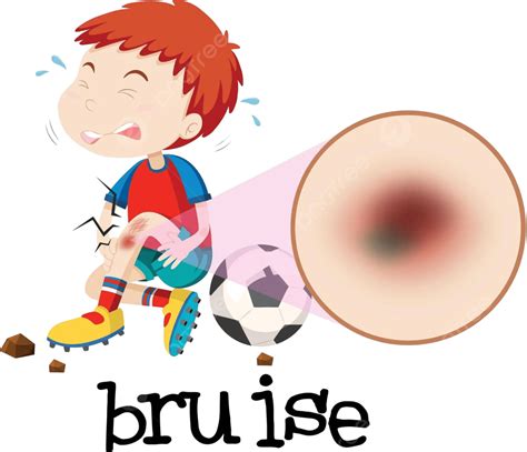 A Young Boy Habing Bruise Picture Injured People Vector Picture