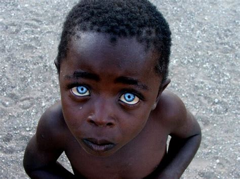 Oddly enough, i have carried a very eastern european type last name through my life. Pictures Of Blacks With Blue Eyes: Natural Phenomenon Or ...